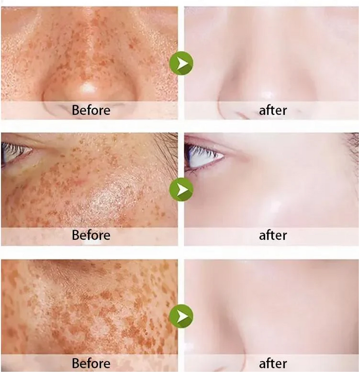 SKIN WHITENING GUMMIES WITH GLUTATHIONE + COLLAGEN + BIOTIN
