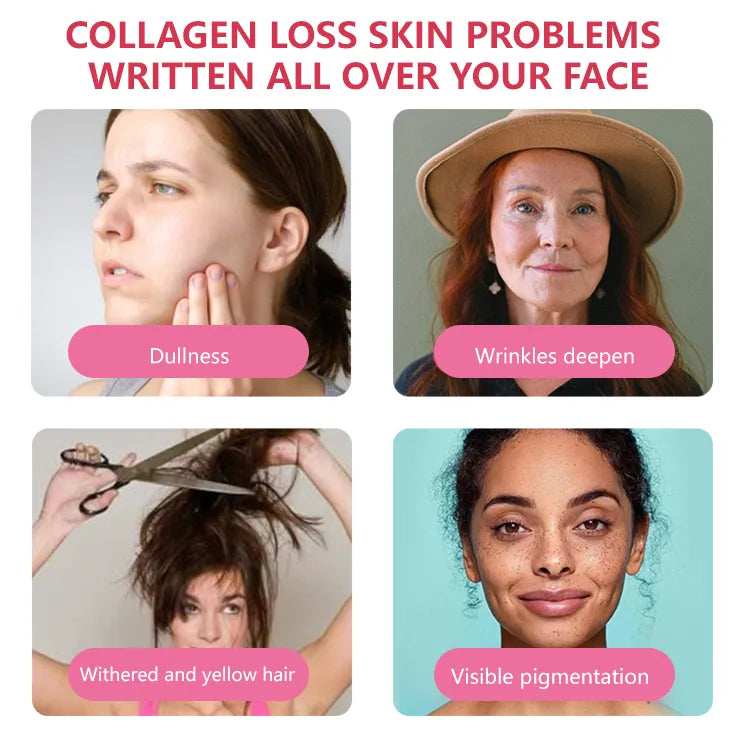 SKIN WHITENING GUMMIES WITH GLUTATHIONE + COLLAGEN + BIOTIN