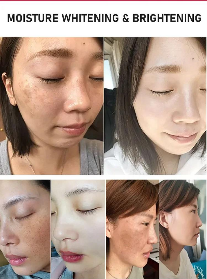 SKIN WHITENING GUMMIES WITH GLUTATHIONE + COLLAGEN + BIOTIN
