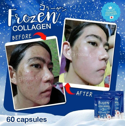 Double pack : Frozen Detox + Frozen Collagen Whitening x10 Glutathione