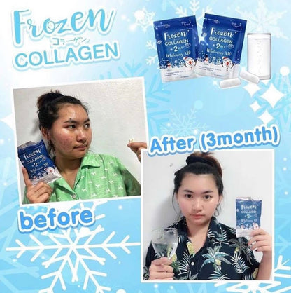 Double pack : Frozen Detox + Frozen Collagen Whitening x10 Glutathione