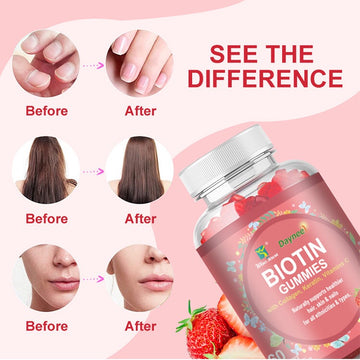 Biotin Gummies - Stronger Hair, Glowing Skin, Healthier Nails – All in One Gummy