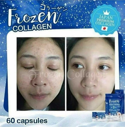 Ultimate Glow Set: Frozen Detox & Collagen Whitening x10 Glutathione